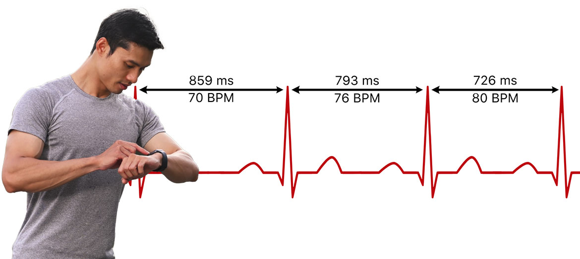 HRV